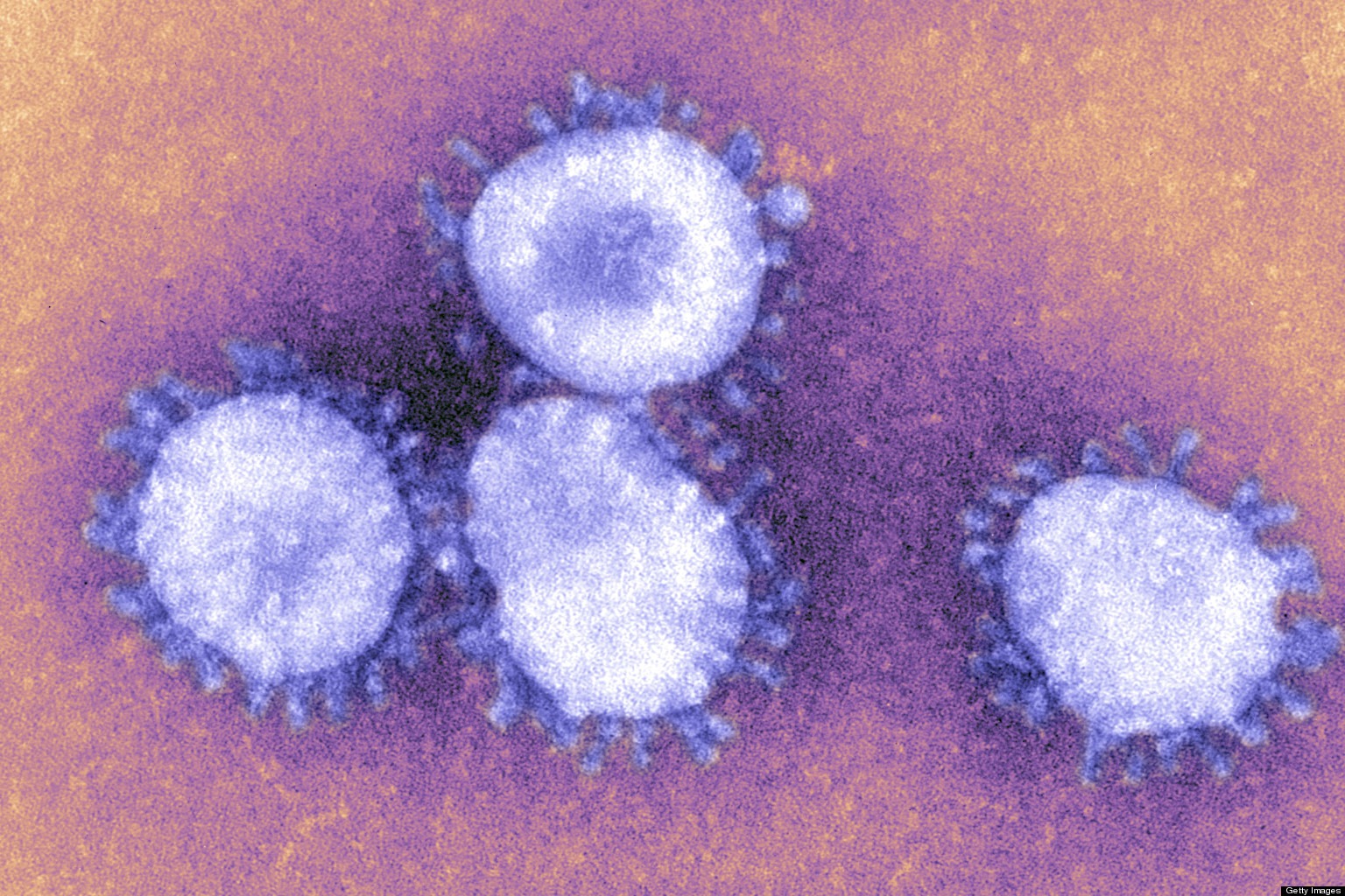 MERS
