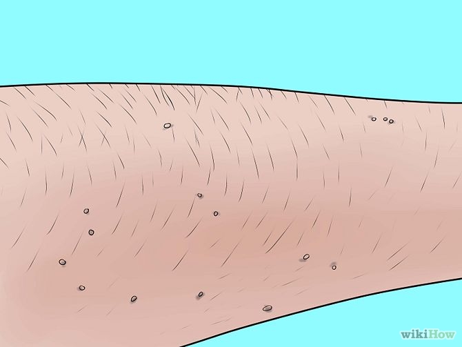 compare-lip-waxing-products-with-other-hair-removal-products