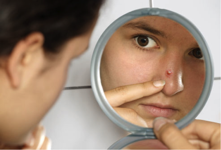 zit