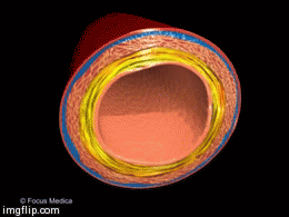 hypertension bl vess constrct