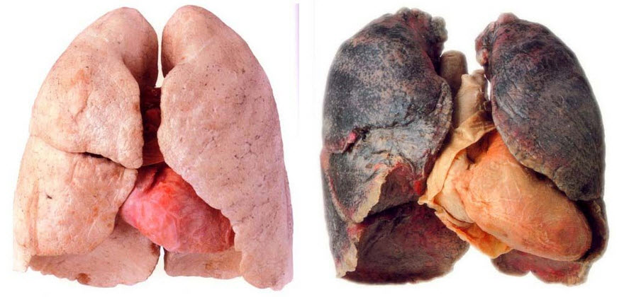 lungs