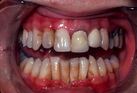 oral changes 2