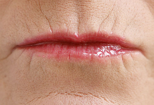 webmd_rf_photo_of_lips_close_up