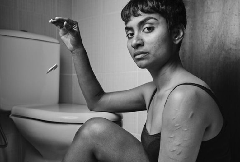 Rock Your Ugly: Dubai-Based Photographer Waleed Shah’s Exploration of Body Insecurities